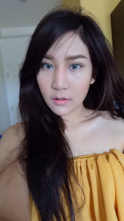 Gương mặt thon gọn của cô gái sau khi thẩm mỹ cắt thịt ở hai bên má