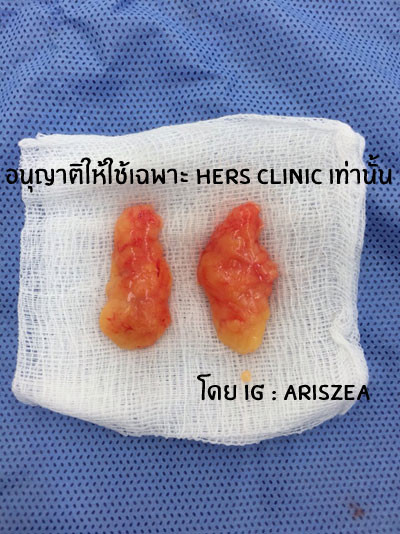 Phần thịt mỡ hai bên mặt được cắt gọt khéo léo.