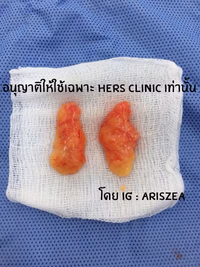 Phần thịt mỡ hai bên mặt được cắt gọt khéo léo.