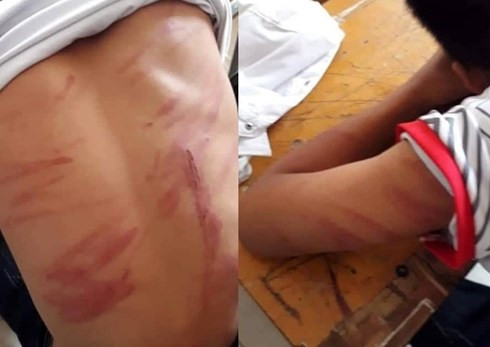 Nghi an hoc sinh lop 8 o Ha Tinh bi bo ruot danh dap da man