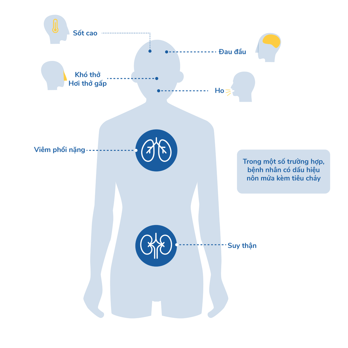 e-Magazine: Toan canh dich benh viem duong ho hap cap do chung moi cua virus corona 2019-nCoV-Hinh-4