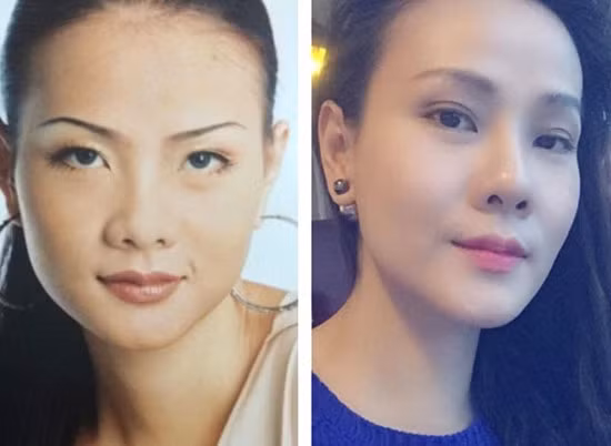 Dương Yến Ngọc từng tiết lộ, năm 2006 cô đã trải qua một ca phẫu thuật nâng mũi bằng sụn nhân tạo. Do được làm khá tự nhiên nên hầu như không có ai đặt ra nghi vấn dao kéo với cô.