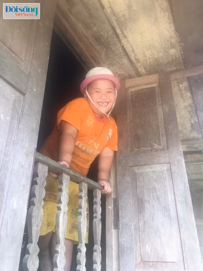 Cau be “Thanh Giong” 15kg khi tron 5 thang bay gio ra sao?-Hinh-6