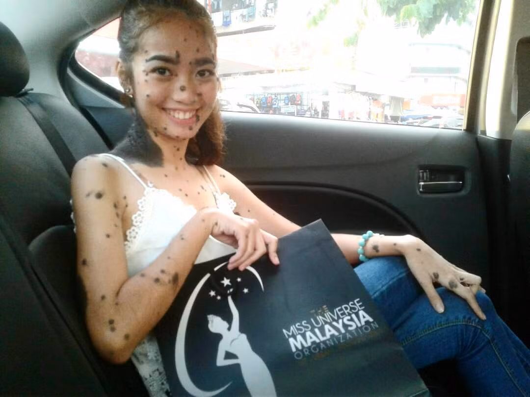 Hiện, Evita đang chờ đợi xem mình có lọt vào vòng tiếp theo của cuộc thi Hoa hậu Hoàn vũ Malaysia hay không. Nhưng ngay cả khi cô ấy không thành công, Evita nói rằng cuộc thi đã làm cho cô tự tin hơn và cô sẽ tiếp tục tham gia các cuộc thi sắc đẹp khác trong tương lai để chứng minh rằng tất cả mọi người đều đẹp theo cách riêng của mình. (Nguồn Bored Panda)