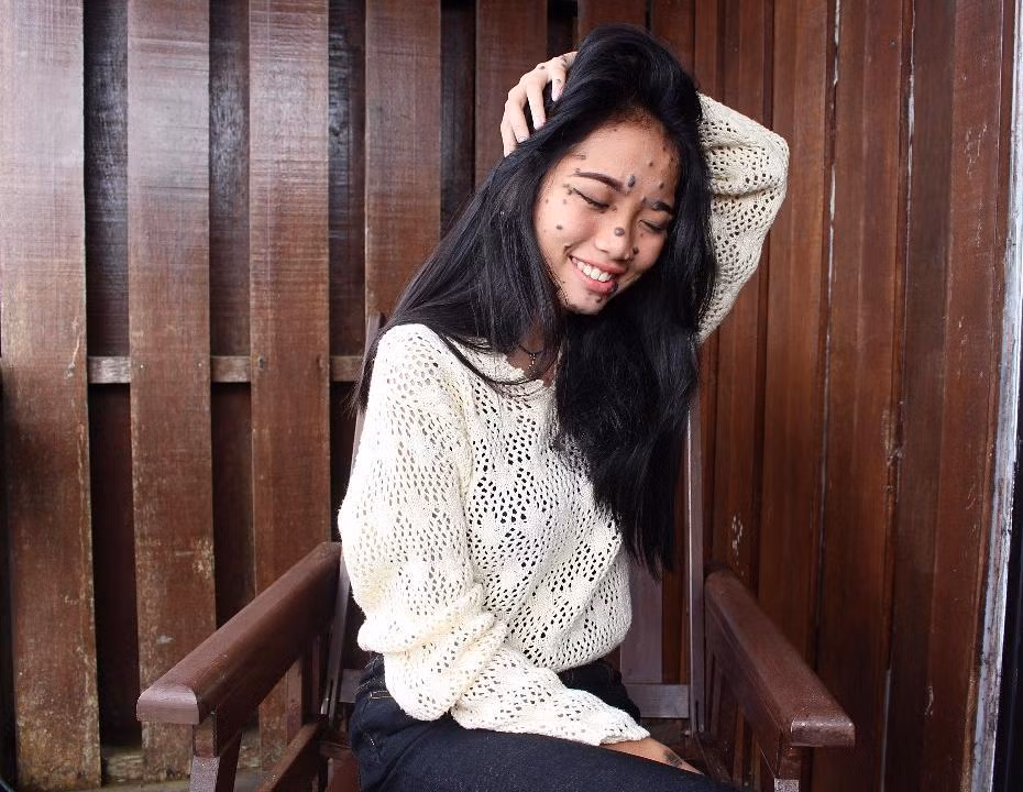 Từ một cô gái bị coi là quái vật xấu xí, từng rất đau khổ vì ngoại hình chẳng giống ai của mình, Evita đã từng bước lột xác về mặt tinh thần, trở nên lạc quan, yêu đời và vô cùng xinh đẹp. (Nguồn Bored Panda)