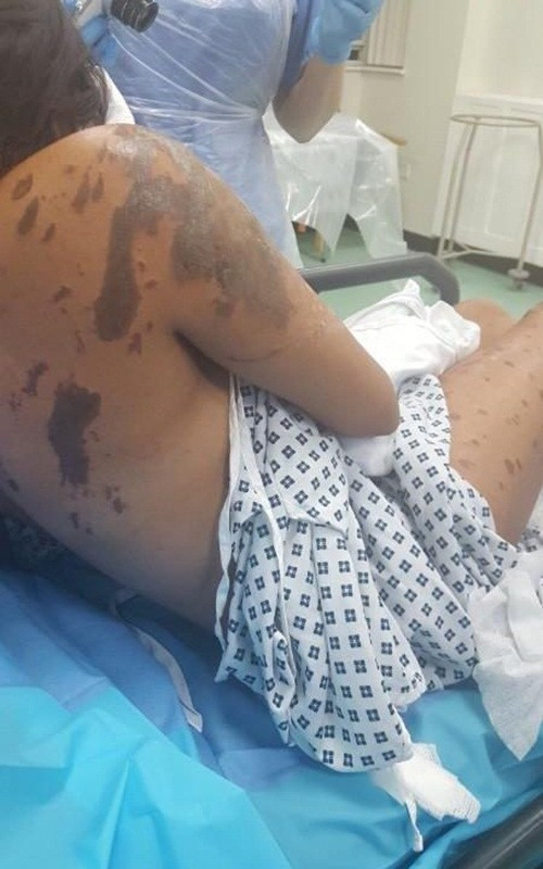 Resham cũng hy vọng cảnh sát sẽ bắt được kẻ gây án càng sớm càng tốt, để hắn phải chịu trách nhiệm cho điều đáng sợ mà mình đã gây ra. (Nguồn Youthwant)