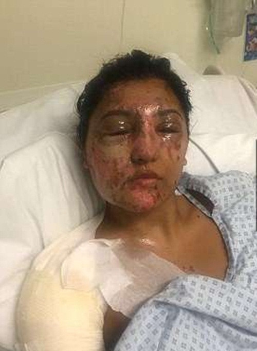 Resham cho biết cô rất biết ơn những người đã giúp đỡ mình và hứa sẽ tích cực đối mặt với mọi khó khăn sau khi bình phục. Bạn bè của Resham cũng đã phát động một cuộc gây quỹ trên Internet, cố hết sức giúp cô và anh trai của mình sống sót, vượt qua tai họa từ trên trời rơi xuống này. (Nguồn Youthwant)