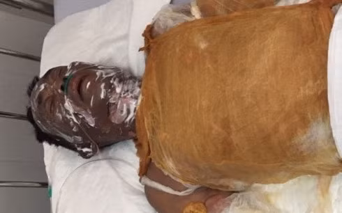 Gianh tiep vien karaoke, nguoi dan ong bi tuoi xang thieu song