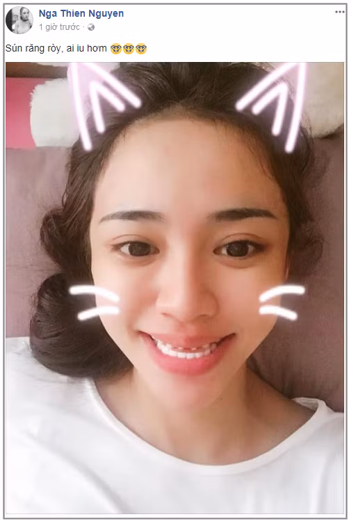 Hot girl Thien Nga khoe anh mai rang, nu cuoi lom chom