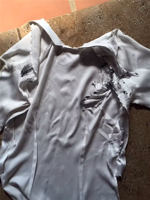 Trước đó, nhà thiết kế Đức Hùng cũng từng chia sẻ trên trang cá nhân câu chuyện con gái anh (tên thường gọi là Bông) bị tai nạn do không cuộn tà áo sau vào phía bụng nên bị nan hoa xe máy hút vào bánh xe. Đồng thời, NTK cũng khuyên các học sinh nên mang áo dài đến trường rồi mới thay. Nếu mặc áo tài từ nhà phải thật lưu ý để tà áo không gây nguy hiểm cho bản thân khi di chuyển bằng ô tô, xe đạp. Ảnh: FB NKT Đức Hùng.