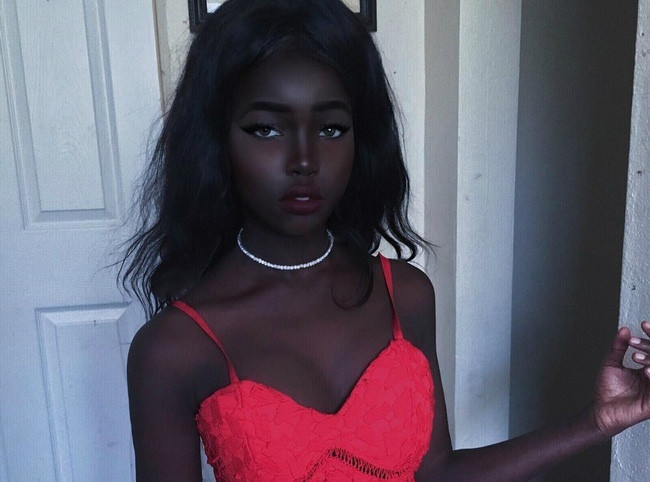 Sau hiện tượng cô gái da đen Khoudia Diop, một cô gái có làn da đen kì lạ khác cũng đang gây xôn xao mạng xã hội.