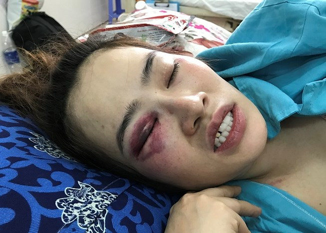 Quán bánh xèo nơi xảy ra sự việc. Ảnh: HẢI HIẾU