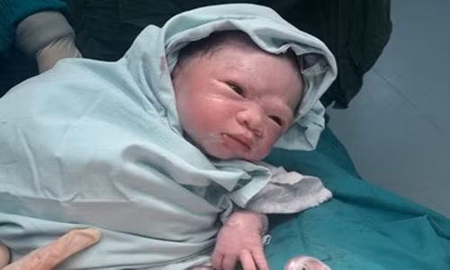 Hy hữu trường hợp thai nhi bị dây rốn cuốn 2 vòng cổ ở Tuyên Quang Hy huu truong hop thai nhi bi day ron cuon 2 vong co o Tuyen Quang