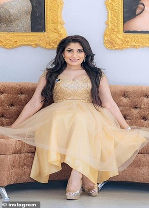 Theo Pushpika De Silva, cô bị thương trên đầu và phải vào bệnh viện để điều trị. Ảnh: Dailymirror và Dailymail