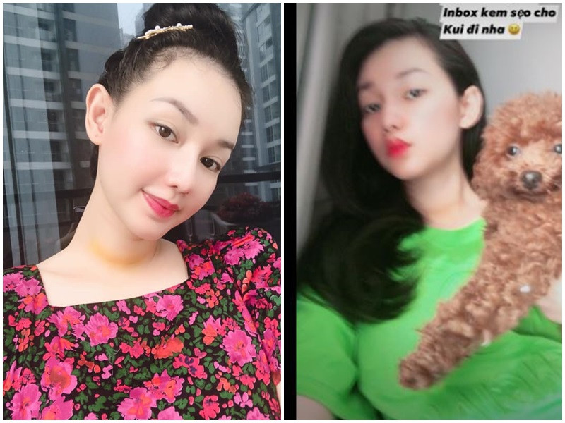 Mới đây, bà mẹ một con bất ngờ cho biết, cô có tế bào ung thư tuyến giáp thể nhú, đang trong quá trình xâm lấn vào mạch máu nên đã phẫu thuật. Hiện tại, sức khỏe của Quỳnh Chi đã ổn định hơn.