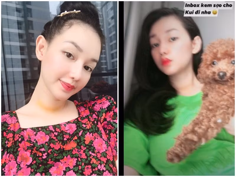 Mới đây, bà mẹ một con bất ngờ cho biết, cô có tế bào ung thư tuyến giáp thể nhú, đang trong quá trình xâm lấn vào mạch máu nên đã phẫu thuật. Hiện tại, sức khỏe của Quỳnh Chi đã ổn định hơn.