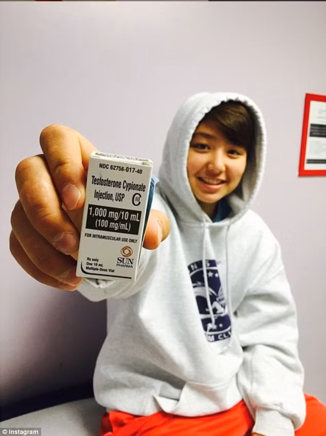 Bailar sử dụng thêm hormone nam để tăng vẻ nam tính.