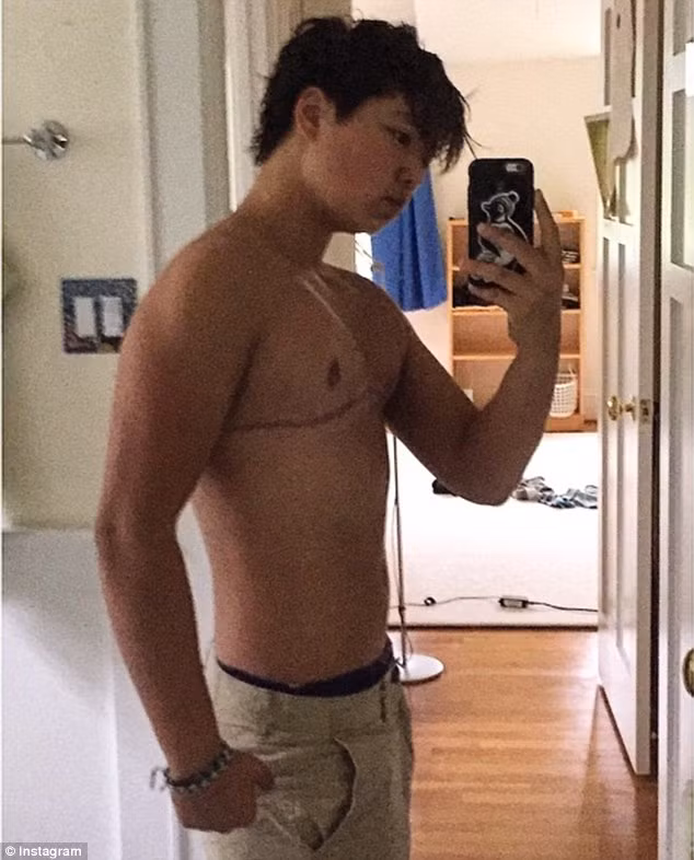 Chế độ tập luyện cùng với việc uống bổ sung hormone giúp sinh viên này từ một cô gái yếu đuối trở thành một anh chàng khỏe mạnh, cường tráng.