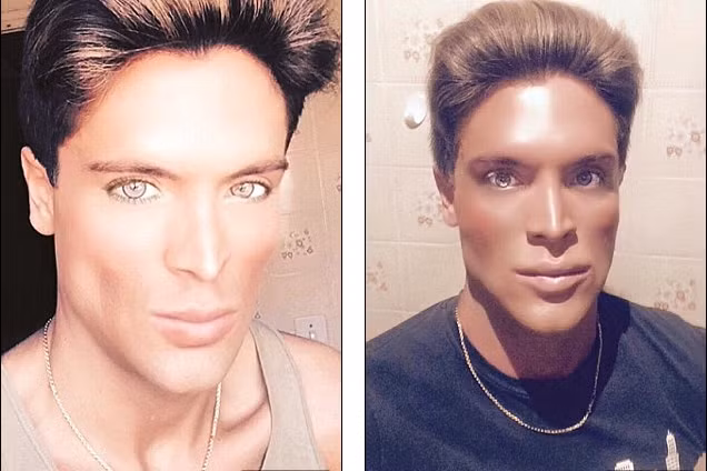 Mauricio tự biến mình thành búp bê sống Ken bằng cách thực hiện các ca phẫu thuật thẩm mỹ.