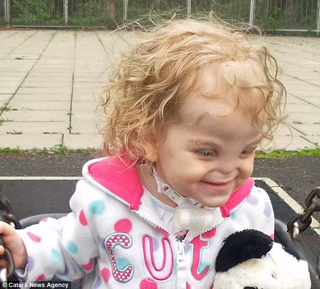 Họ cũng công khai chia sẻ câu chuyện của mình với hy vọng nó sẽ gợi nguồn cảm hứng cho các gia đình và cá nhân khác, để "không đứa trẻ nào bị thiếu tình yêu thương và bị bỏ rơi vì các khác biệt và bệnh tật của chúng".