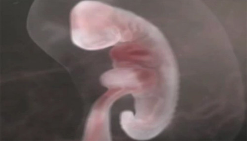 Điều đó kéo theo những chuyển hóa nhạy cảm của trứng, kết quả là sẽ gây nguy hại nghiêm trọng cho quá trình thụ thai. Thêm nữa, hiện tượng viêm nhiễm có thể làm hại các tế bào và nếu nó xảy ra với trứng thì sẽ tác động xấu đến sự “sống sót” của bào thai.