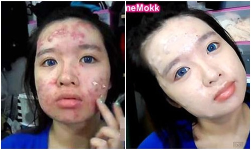 Clip trang diem che mụn rùng rọn khién bác sĩ hét hòn