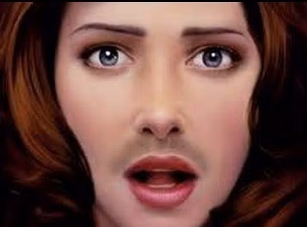 Lông mọc dày bất thường trên cơ thể - dấu hiệu mắc hội chứng buồng trứng đa nang. Ước tính có một nửa số bệnh nhân mắc căn bệnh nan y -buồng trứng đa nang, có hiện tượng cơ thể có nhiều lông, phân bố lông trên cơ thể theo khuynh hướng giống nam giới, mọc nhiều vào sau thời kỳ dậy thì, ví dụ như ở vùng trên miệng, xung quanh núm vú, đường dọc bụng, xung quanh hậu môn và tứ chi lông mọc tương đối nhiều, thô và đen.