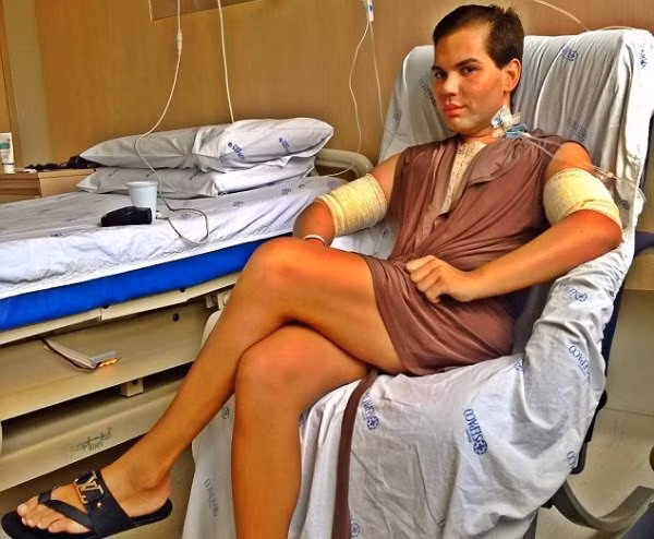 Hồi cuối năm ngoái, anh chàng này cũng chi khoảng 200 triệu đống chữa chứng hói đầu bằng cách tiêm tế bào gốc lấy mỡ từ lưng và trộn với máu vào da đầu anh này, thủ thuật kéo dài khoảng 4 tiếng.