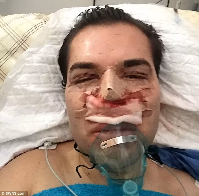 Rodrigo Alves công khai tất cả các hình ảnh phẫu thuật thẩm mỹ của mình lên mạng.