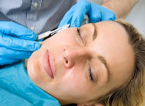 Xóa nếp nhăn bằng dao cạo. Với cách làm đẹp này, khách hàng phải nằm yên, nín thở và nhắm mắt cảm nhận lưỡi dao sắc nhọn kia đang lướt dọc ngang khắp khuôn mặt mình. Bất kỳ một cử động nào cũng khiến bạn phải hối hận trong trường hợp này.