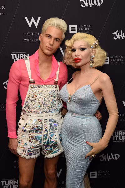 Hôm 4/6, trong sự kiện “Turn it up for change” taị New York, Mỹ, người mẫu chuyển giới Mỹ Amanda Lepore đã thu hút sự chý của nhiều người với khuôn mặt và cơ thể méo mó, biến dạng do biến chứng của phẫu thuật thẩm mỹ.