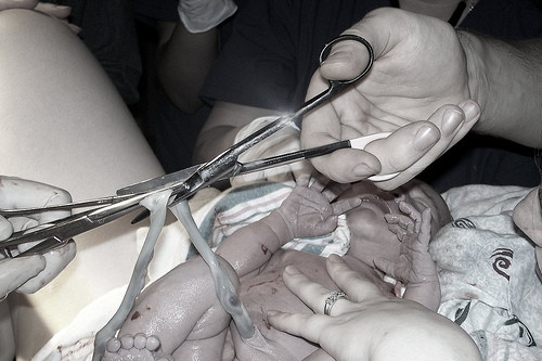 Nguyên nhân là vì việc chậm kẹp dây rốn cho phép máu chứa nhiều sắt truyền sang em bé, rất quan trọng cho sự phát triển. Một số nghiên cứu trước đây đã cho thấy lượng sắt thấp làm suy giảm khả năng học, nói và hiểu của trẻ, cũng như liên quan đến những tình trạng bệnh như tăng động giảm tập trung.