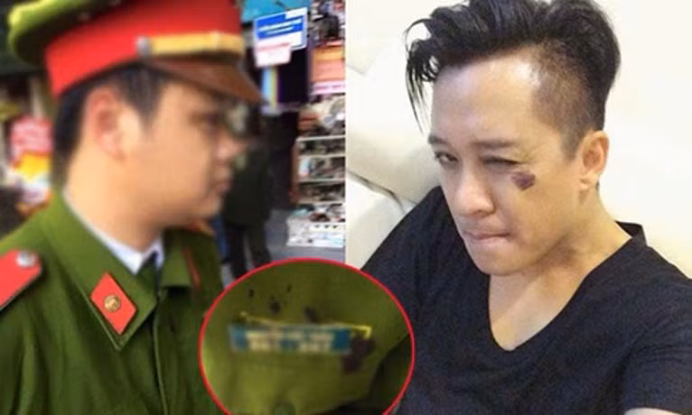 Co hay khong viec ca si Tuan Hung danh cong an phuong?