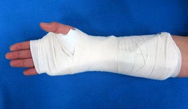 Tại cụm thi do Trường ĐH Công nghiệp thực phẩm TP.HCM chủ trì, thí sinh Đỗ Thị Thao (học sinh Trường THPT Lê Minh Xuân, TP.HCM) bị tai nạn và gãy cánh tay phải. Nhằm đảm bảo quyền lợi cho thí sinh gãy tay, hội đồng thi cụm thi này đã đề xuất một học sinh lớp 11 của Trường THPT Lê Minh Xuân sẽ hỗ trợ ghi bài thi cho thí sinh Đỗ Thị Thao.