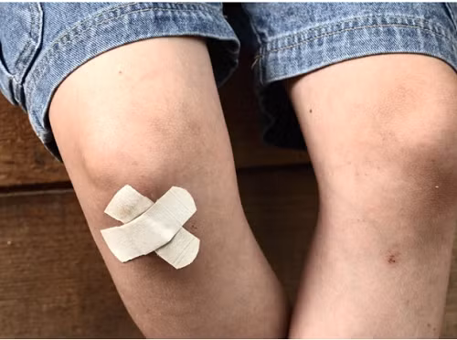 Băng gâu. Băng gâu rất cần thiết khi có nốt phồng rộp hoặc vết thương bất ngờ. Tích trữ chúng trong nhà là cần thiết song sản phẩm này có hạn sử dụng khoảng 5 năm. Qua khoảng thời gian này, băng gâu mất khả năng sát trùng, hoạt động không hiệu quả.