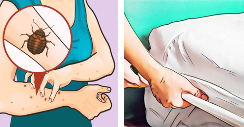 Kiểm tra giường, nệm. Kiểm tra giường, nệm khi nhận phòng khách sạn nhằm mục đích xem có rệp hay dị vật hay không. Đừng nghĩ chỉ những khách sạn giá rẻ mới có rệp. Ngay cả giường ở khách sạn 5 sao cũng có thể chứa rệp. (Ảnh: BS, minh họa)