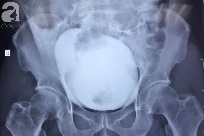 Nhin tieu tu Vung Tau ve TP HCM, nguoi dan ong vo bang quang suyt chet