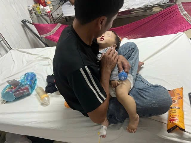 Xác minh vụ việc cháu bé 9 tháng tuổi bị bầm tím 2 má Xac minh vu viec chau be 9 thang tuoi bi bam tim 2 ma