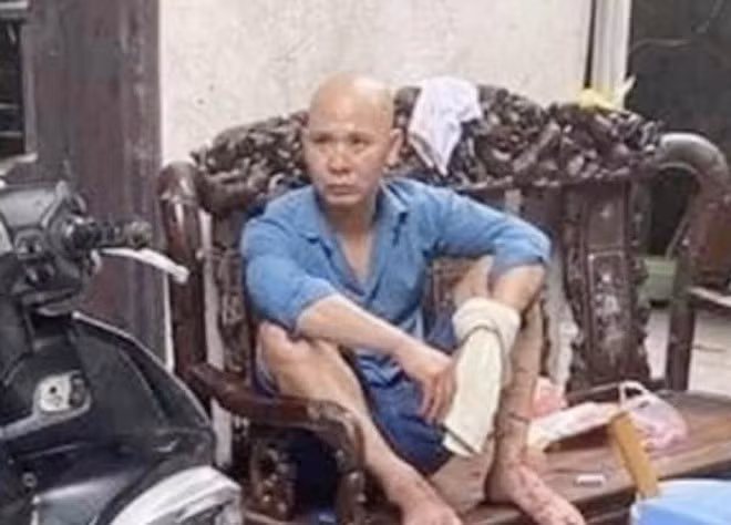 Tin nong 20/5: Ghen tuong, chong chem vo trong thuong-Hinh-2