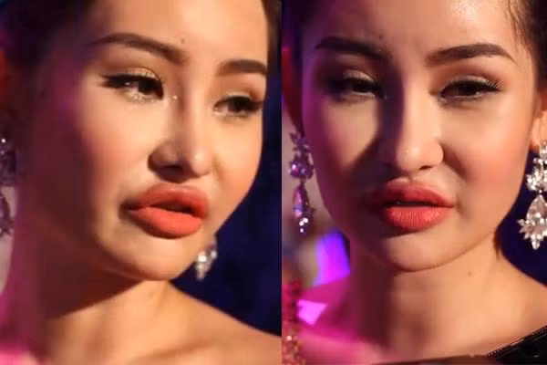 Thời điểm đăng quang Hoa hậu Đại Dương 2017, Lê Âu Ngân Anh đối mặt với làn sóng chê bai dữ dội về nhan sắc của cô. Gương mặt cứng đờ, đôi môi sưng phồng kém tự nhiên khiến người đẹp bị đặt cho nhiều biệt danh không hay.