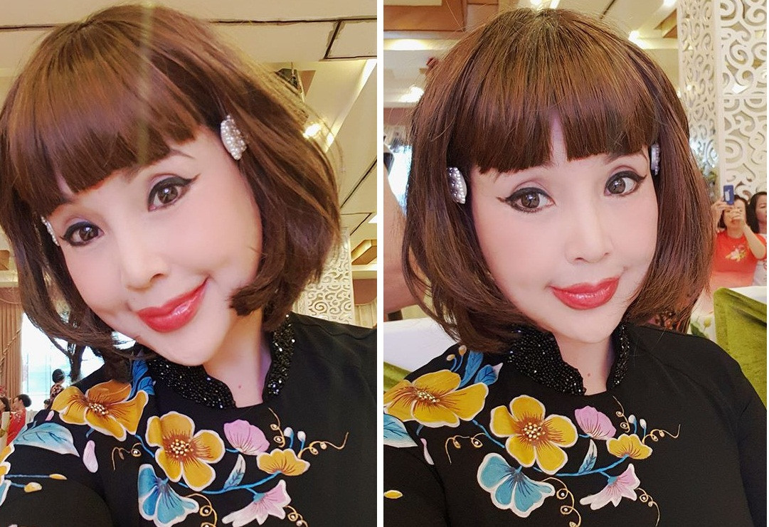 Nữ nghệ sĩ cũng khẳng định không lạm dụng dao kéo vì ngoài phẫu thuật hạ gò má thì mắt, mũi, môi,... của cô đều là tự nhiên.