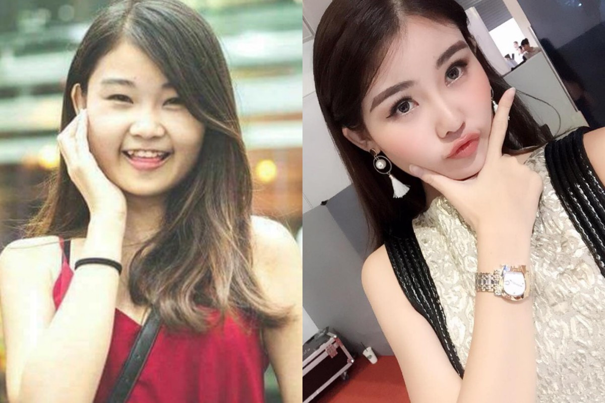 Bức ảnh "ngày ấy - bây giờ" tố Lê Âu Ngân Anh đụng "dao kéo". Người đẹp cũng thừa nhận đã phẫu thuật thẩm mỹ trước khi thi Hoa hậu Đại dương.