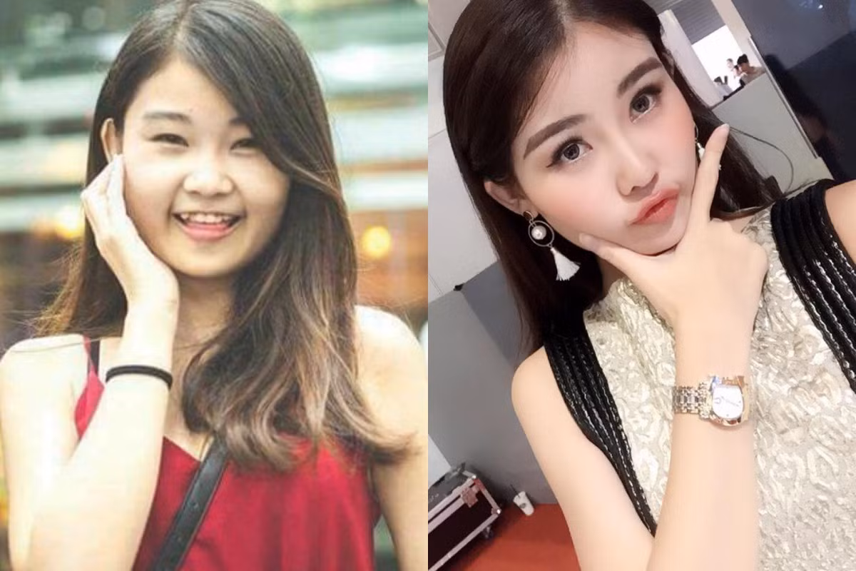 Bức ảnh "ngày ấy - bây giờ" tố Lê Âu Ngân Anh đụng "dao kéo". Người đẹp cũng thừa nhận đã phẫu thuật thẩm mỹ trước khi thi Hoa hậu Đại dương.