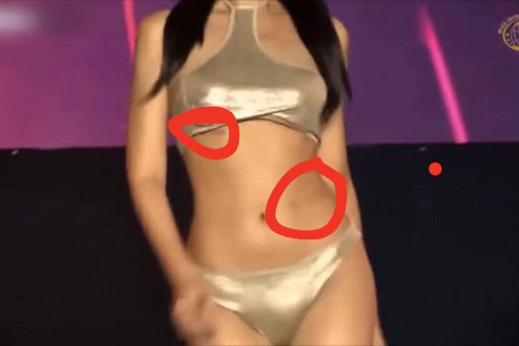 Trước đó, trong phần thi trình diễn áo tắm, Ngân Anh cũng để lộ vết lạ trên cơ thể này.