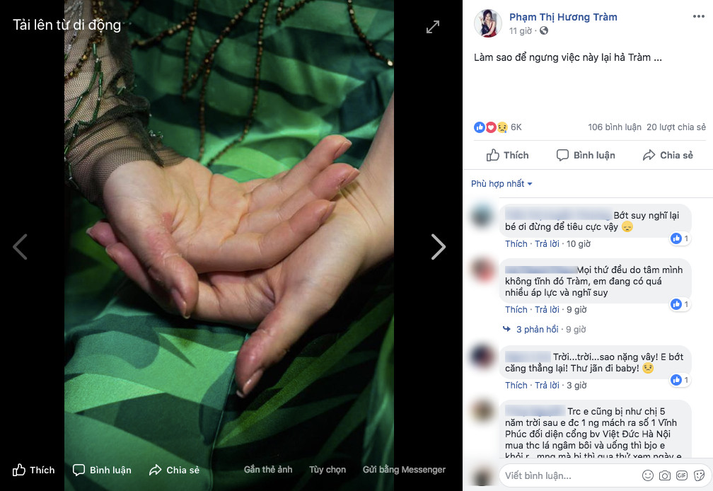 Giọng ca xứ Nghệ từng khiến fan lo lắng cho tình trạng sức khỏe của mình. Suốt 5 năm qua cô phải sử dụng thuốc ngủ liên tục vì những áp lực trong công việc và cuộc sống. Thậm chí, Hương Tràm còn mắc hội chứng rối loạn tâm lý, thường xuyên tự bóc tay mình đến rỉ máu.