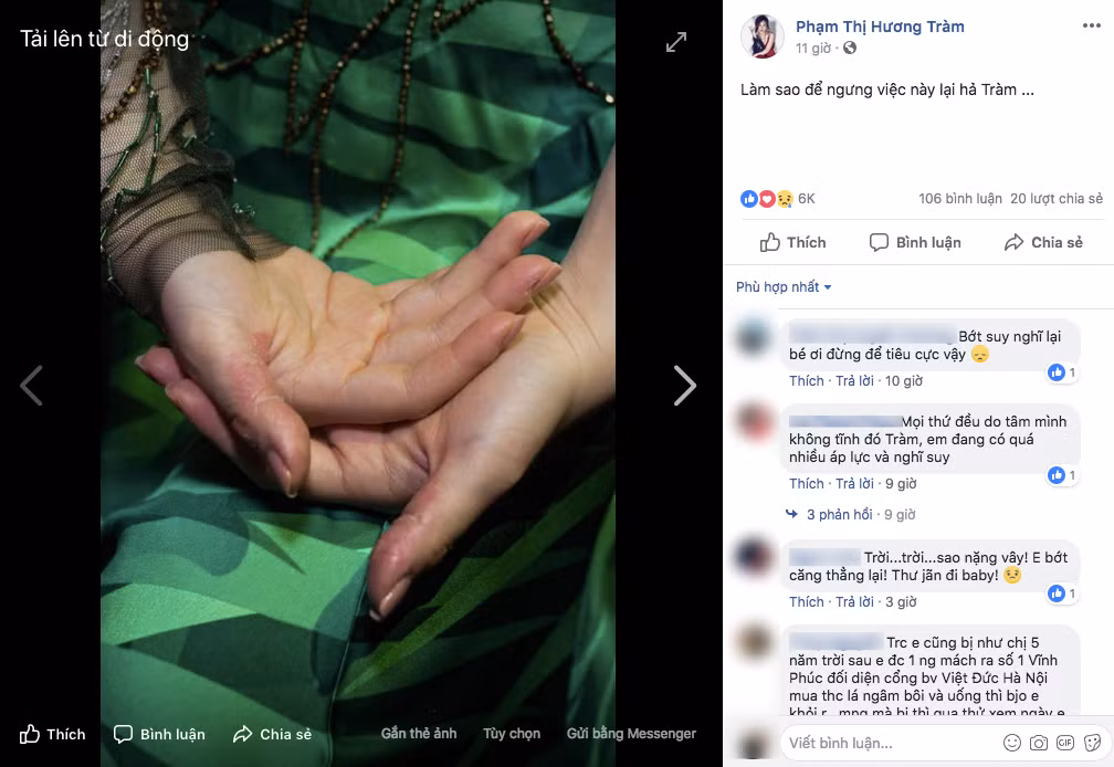 Giọng ca xứ Nghệ từng khiến fan lo lắng cho tình trạng sức khỏe của mình. Suốt 5 năm qua cô phải sử dụng thuốc ngủ liên tục vì những áp lực trong công việc và cuộc sống. Thậm chí, Hương Tràm còn mắc hội chứng rối loạn tâm lý, thường xuyên tự bóc tay mình đến rỉ máu.