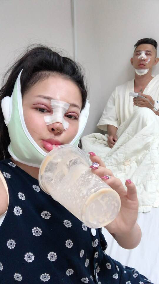 Trước khi công khai gương mặt sau "dao kéo", Lương Bằng Quang không ngại chia sẻ về quá trình phẫu thuật thẩm mỹ của mình và bạn gái tai tiếng Ngân 98. Cô nàng cũng được mệnh danh là hot girl nghiện "dao kéo".