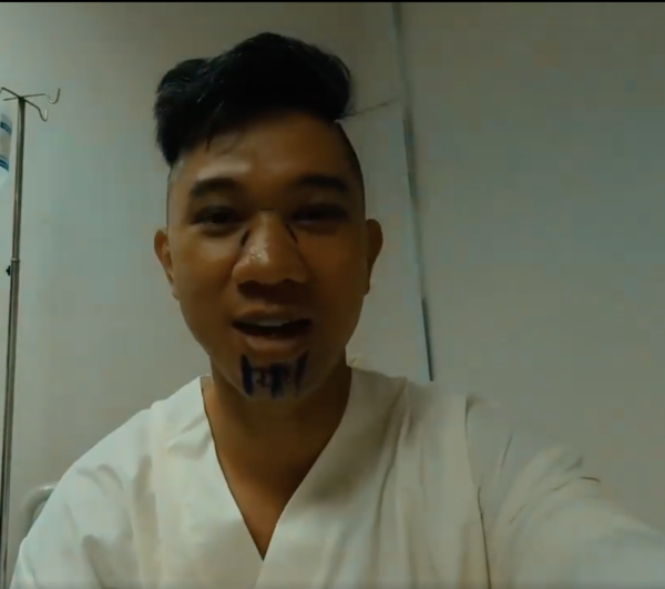 Gương mặt của nam ca sĩ 37 tuổi ngay trước khi thực hiện ca phẫu thuật thẩm mỹ.