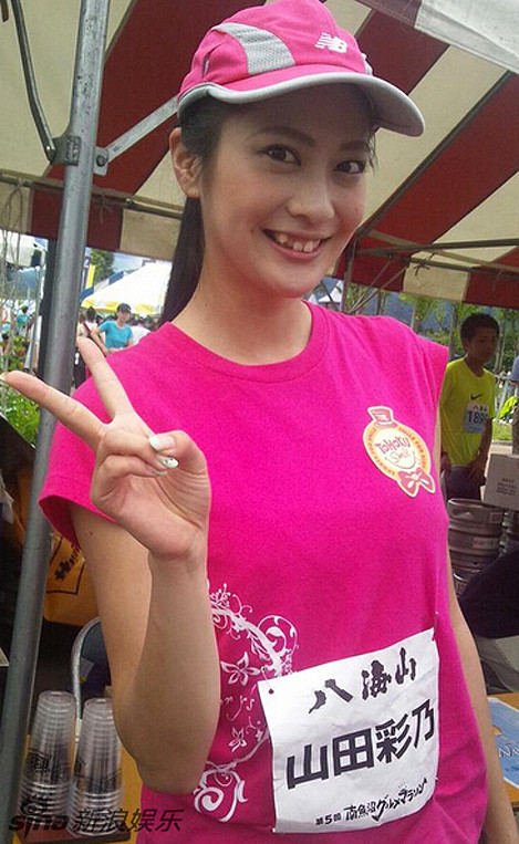 Để khắc phục nhược điểm, Ayano Yamada nhận được lời khuyên nên chỉnh sửa lại hàm răng ố vàng, khấp khểnh của mình. Ảnh: Sina.