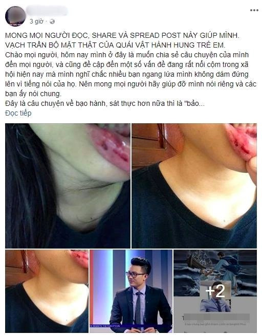 Hơn 1 năm trước, sự việc MC Minh Tiệp bị tố bạo hành em vợ suốt 5 năm cũng từng gây rúng động không chỉ làng giải trí mà còn cả cộng đồng giới trẻ Việt.